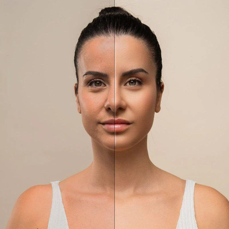 Masajeador Facial Lift Pro